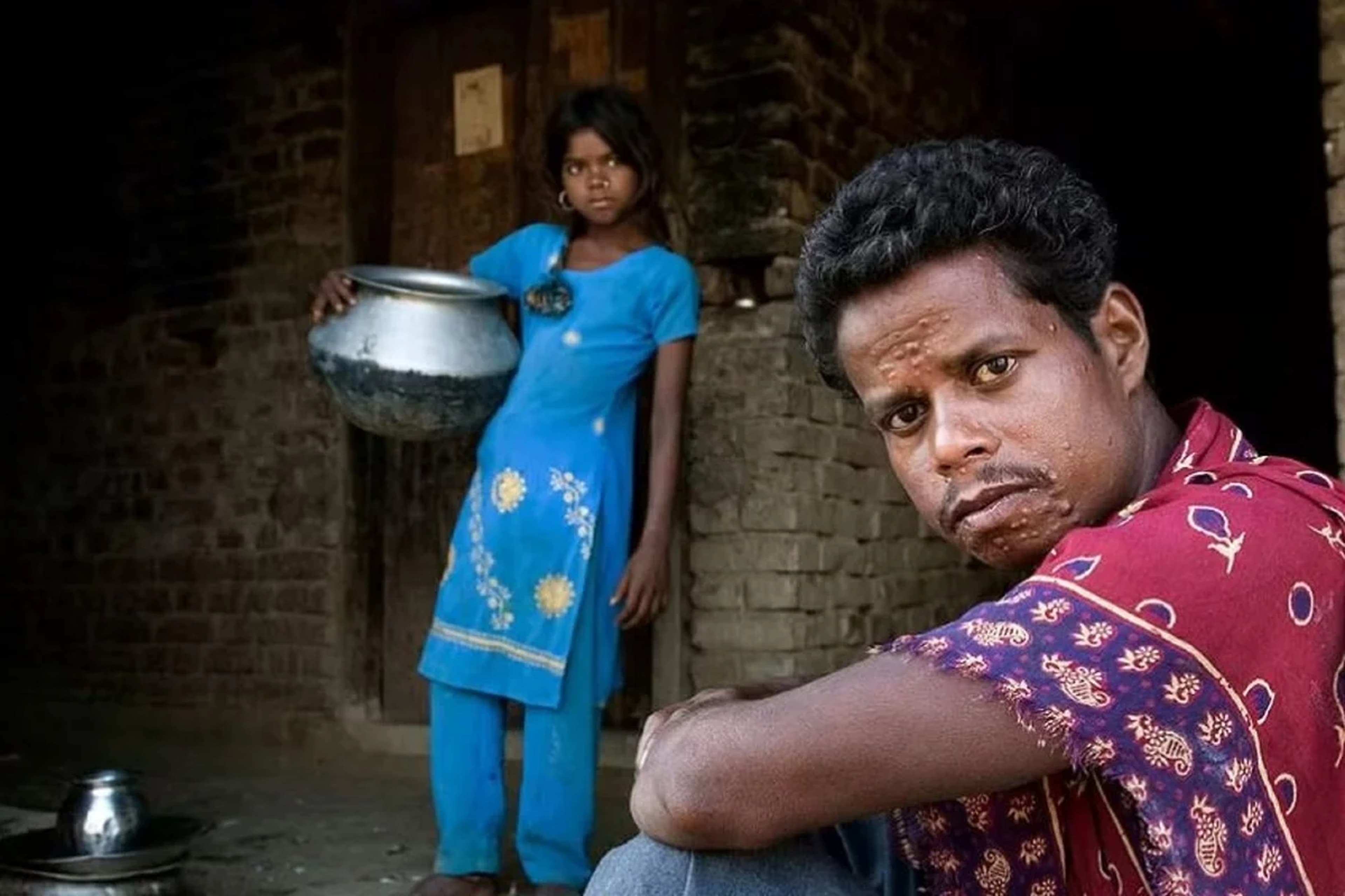 Global Health and Education Watch: Communities unite to address stigma and discrimination affecting people