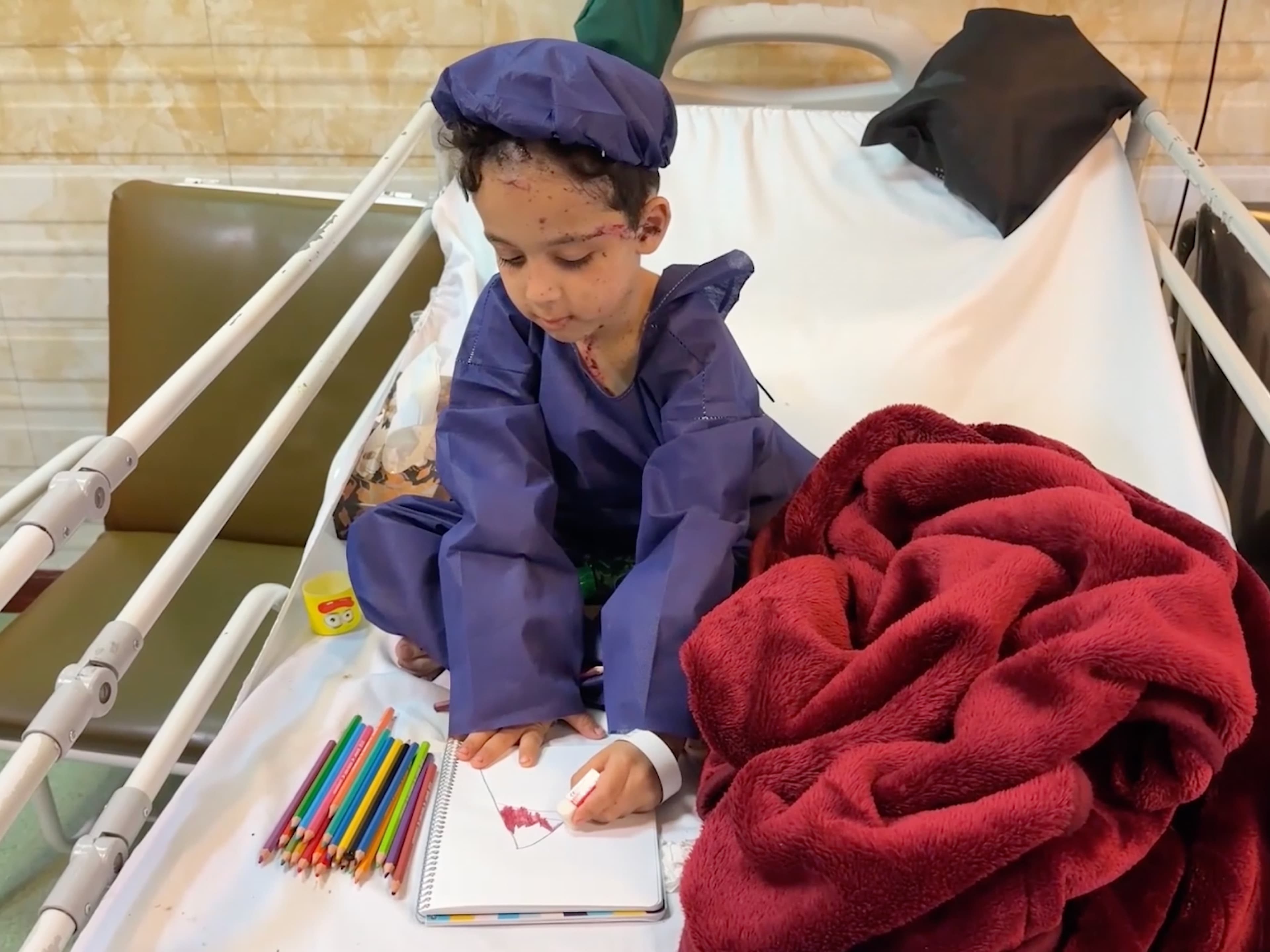 Global Health and Education Watch: Children wounded in the US-Israeli strikes receive treatment in