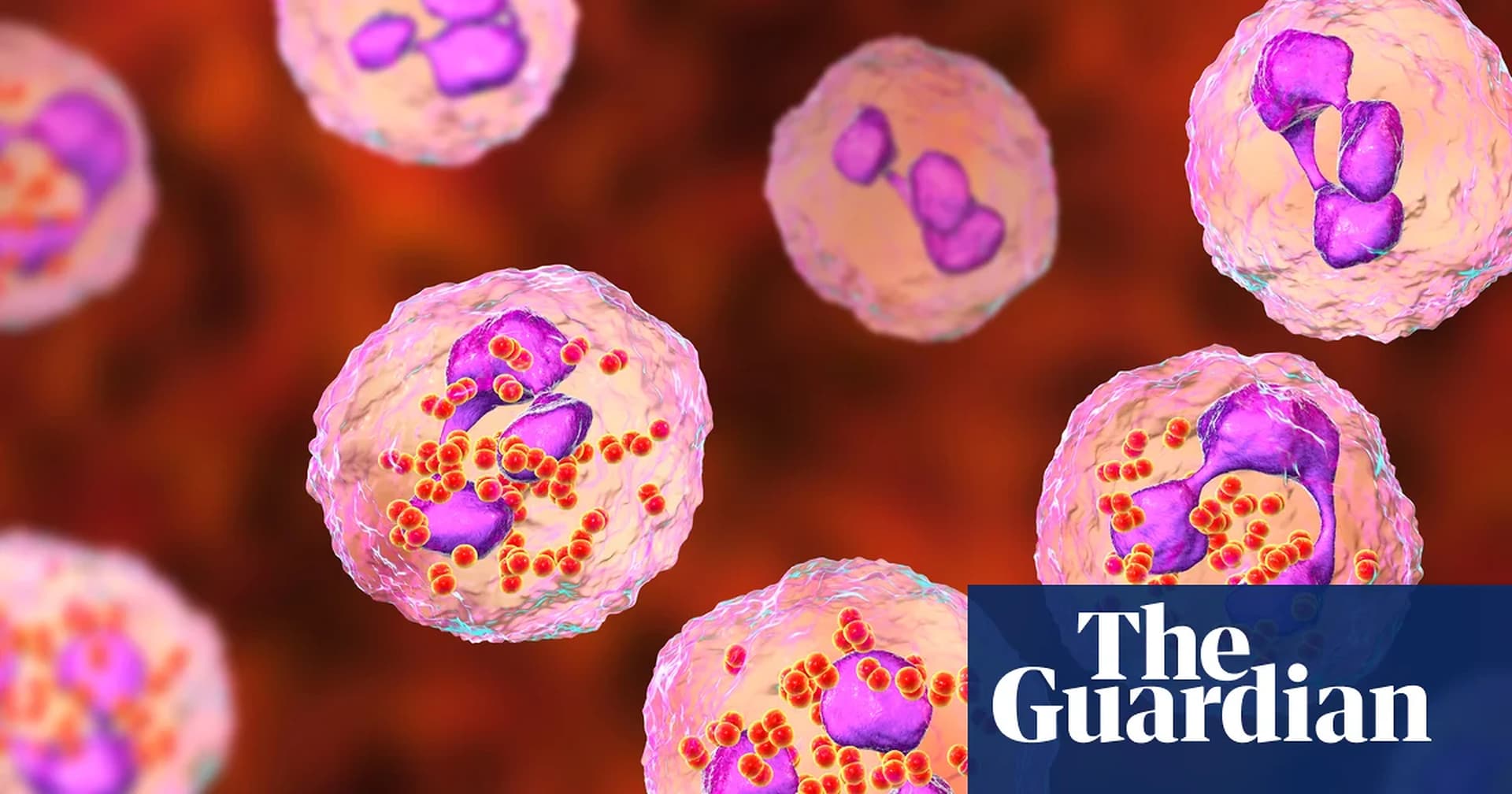 Global Health and Education Watch: Experts consider expanding meningitis vaccine eligibility after Kent outbreak