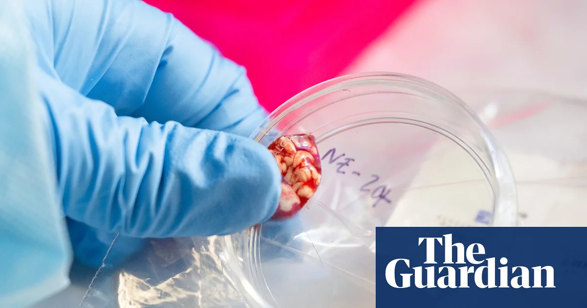 Global Health Alert: CDC Staffing Crisis Halts Critical Disease Testing