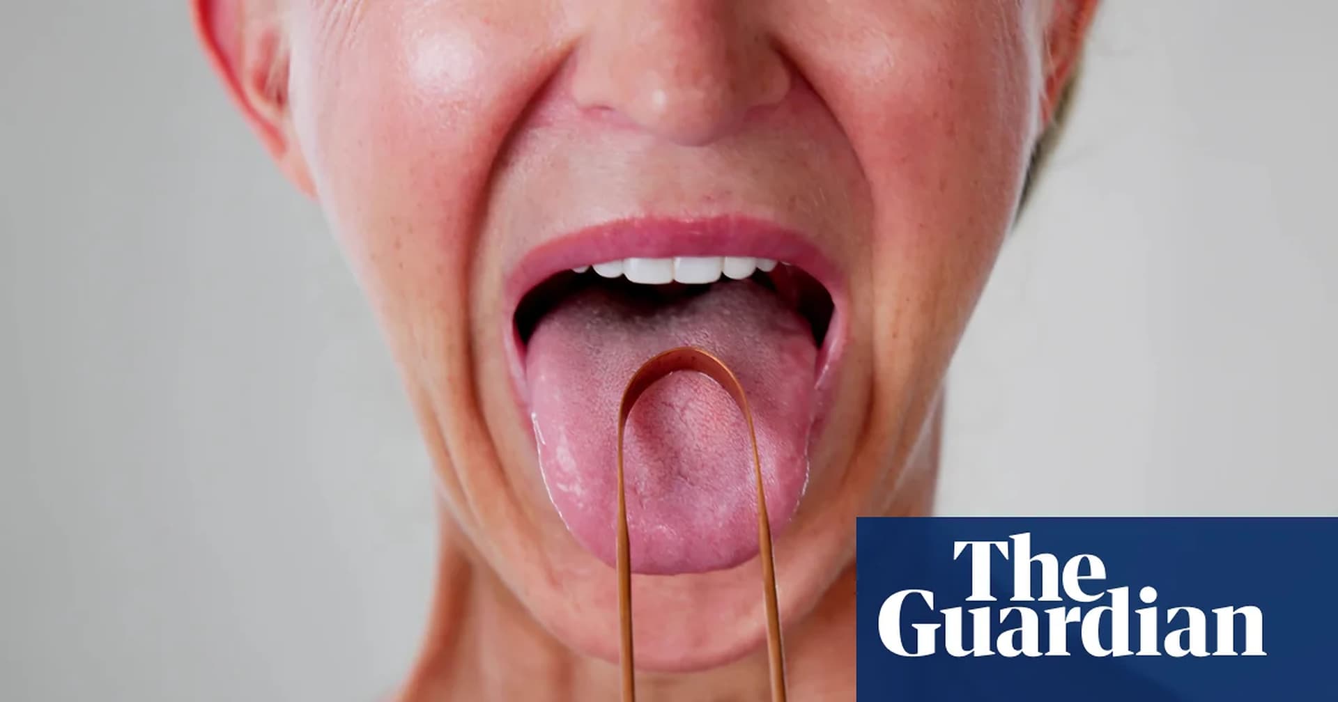 Beyond the Brush: Why Tongue Cleaning is Crucial for Global Oral Health
