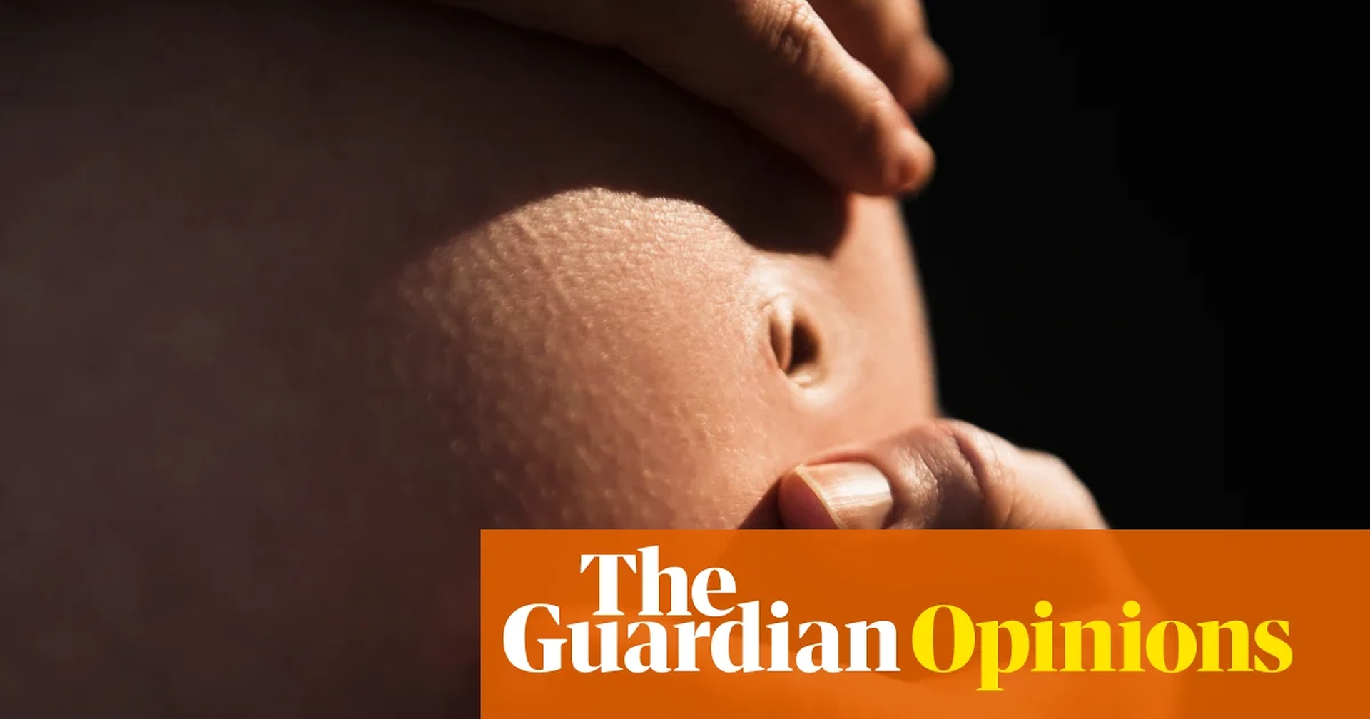 Global Health and Education Watch: Why was a Florida woman forced to have a