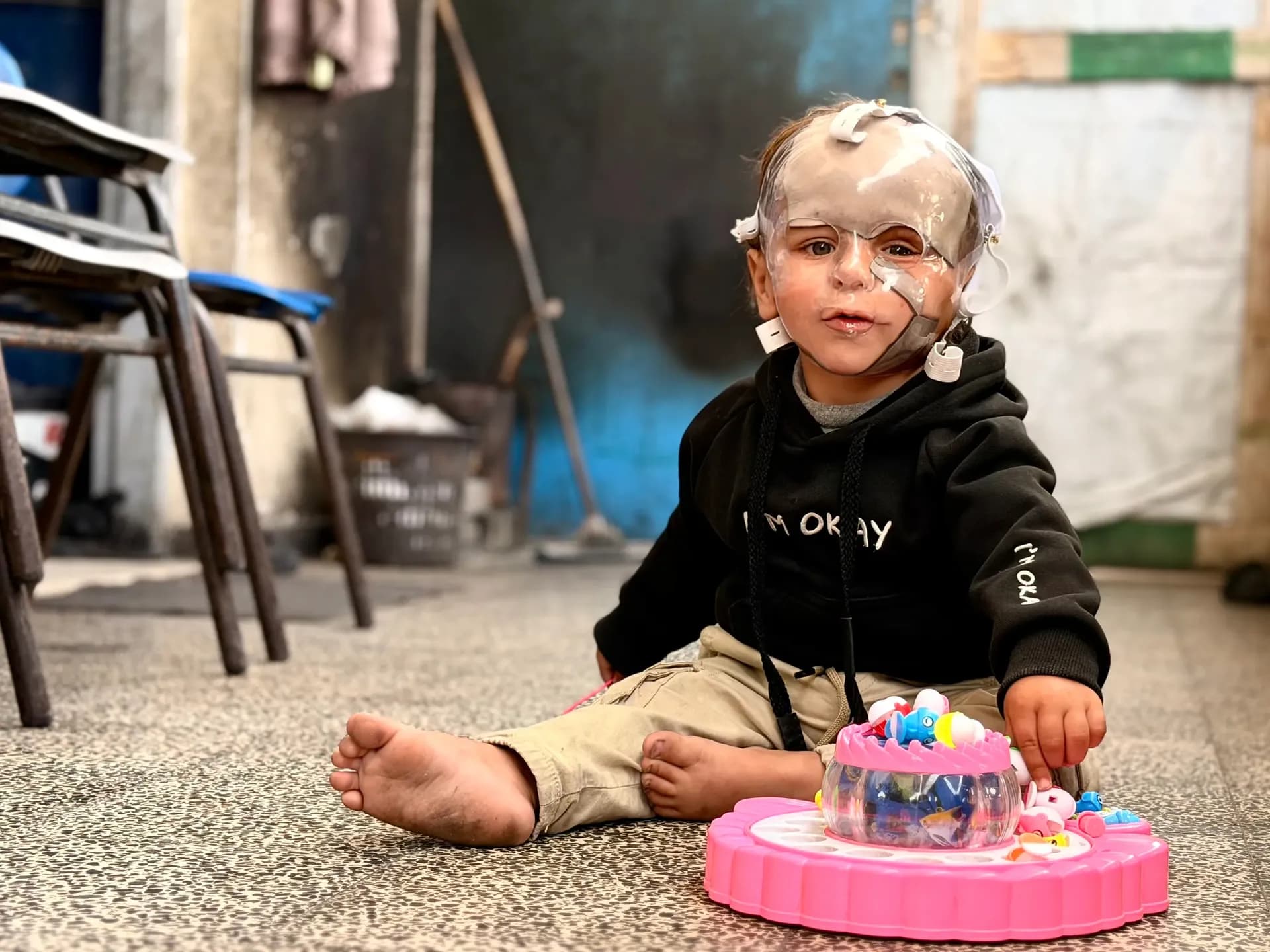 Gaza's Child Survivors Face Lifelong Scars Amidst Collapsed Healthcare