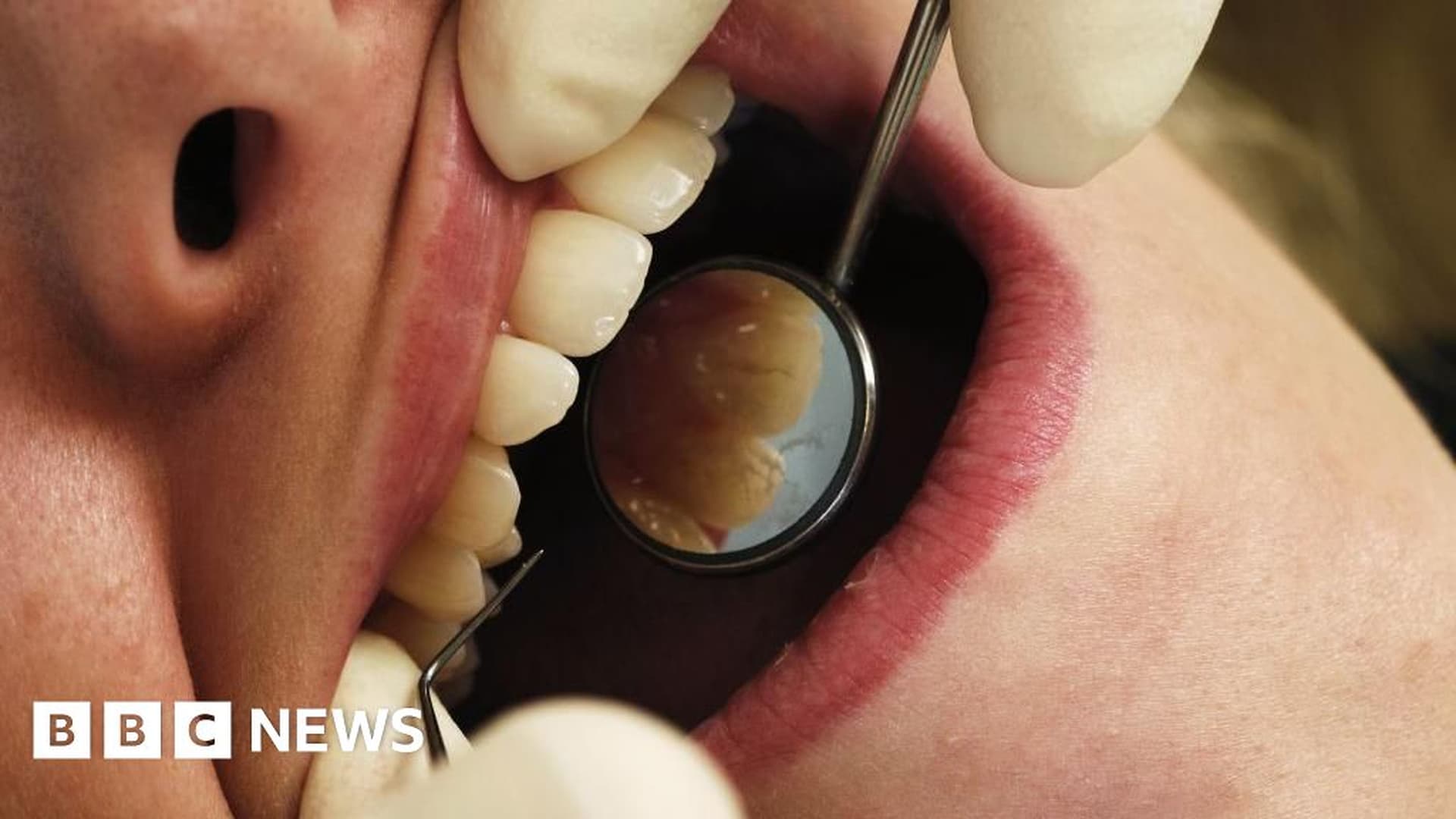 Sydney Dental Clinic Prompts Global Health Warning
