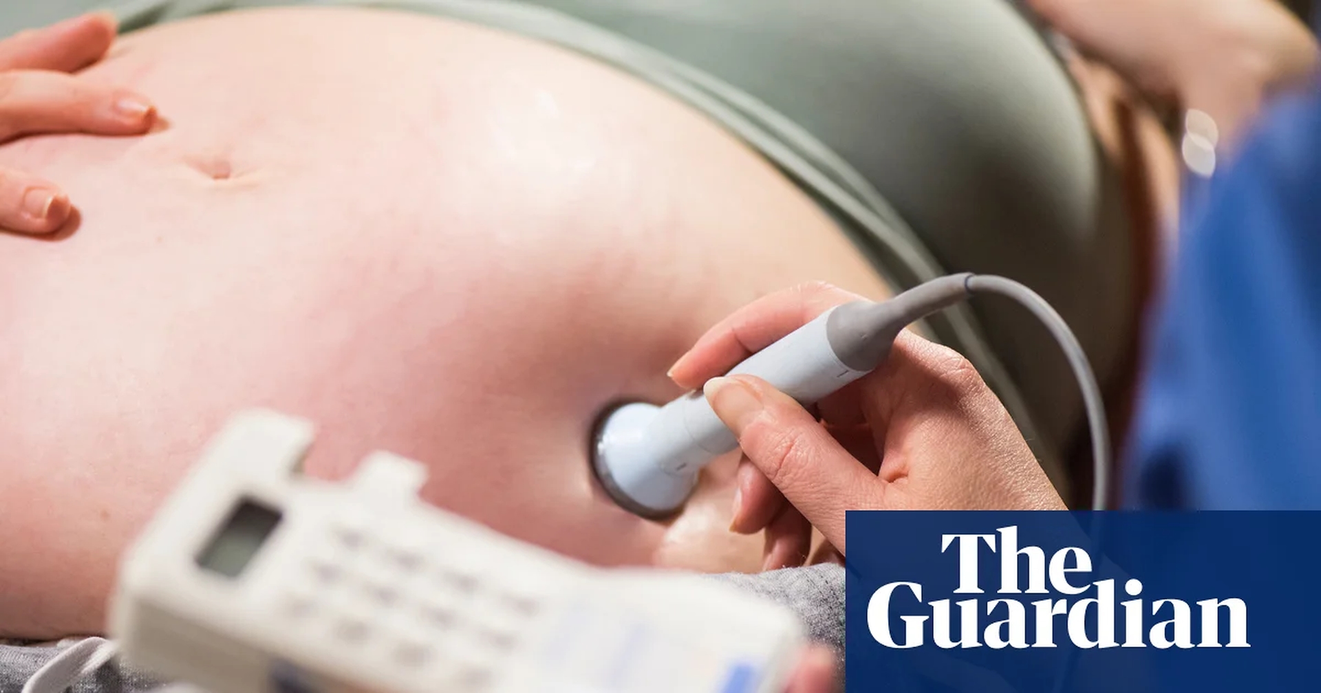 Global Health and Education Watch: Factors leading to failures in NHS maternity care |