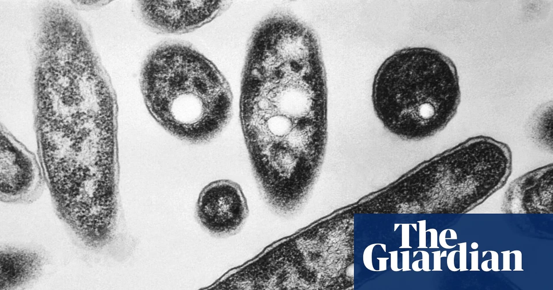 Global Health and Education Watch: Legionnaires’ outbreak rocks New York as experts warn of