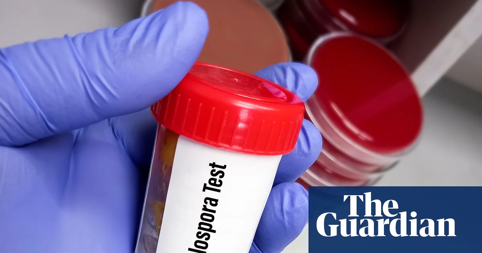 Global Health and Education Watch: Trump’s deep public health cuts hinder response to record