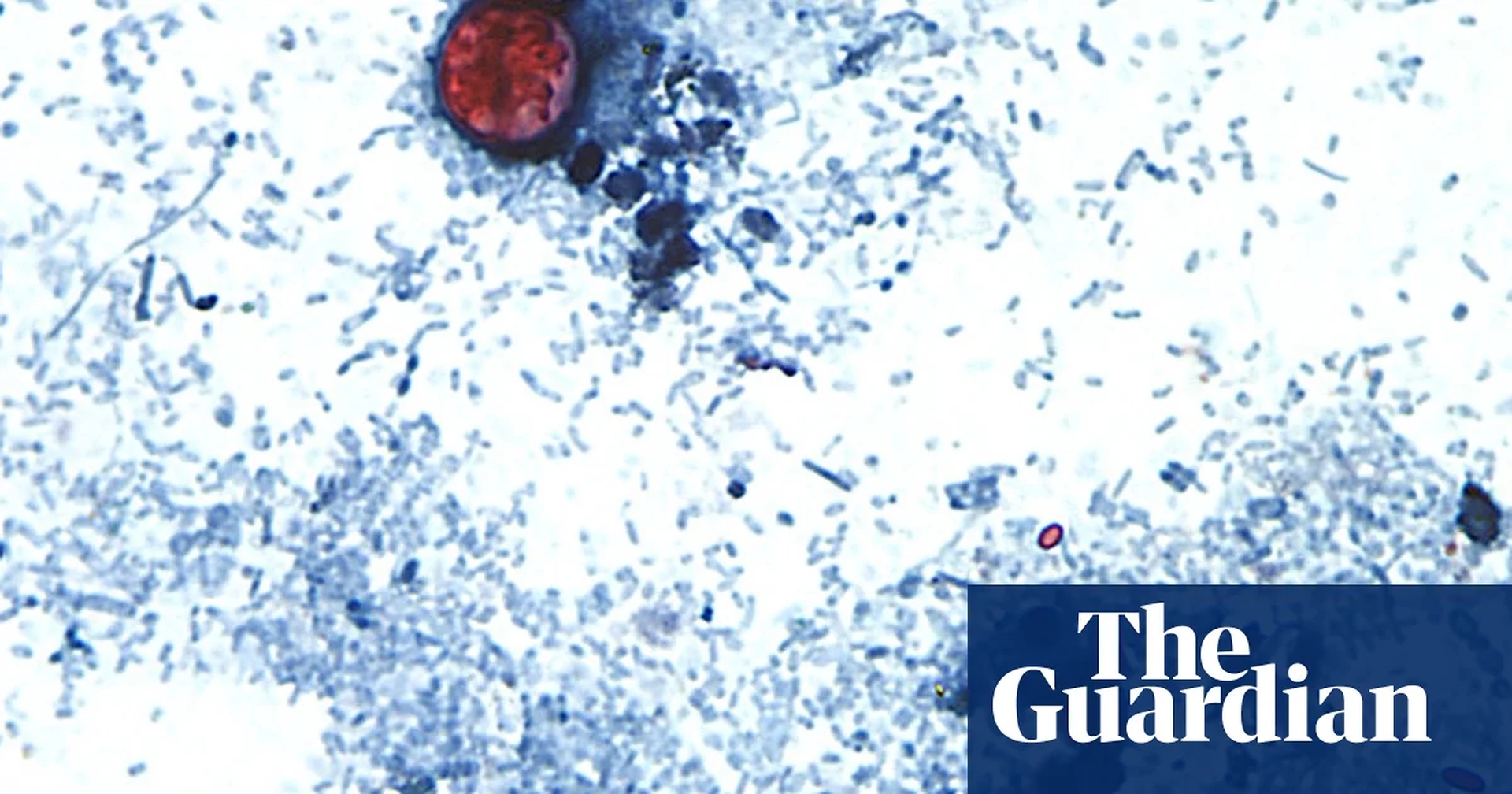 Global Health and Education Watch: Is the cyclosporiasis outbreak slowing? Test-makers are hopeful