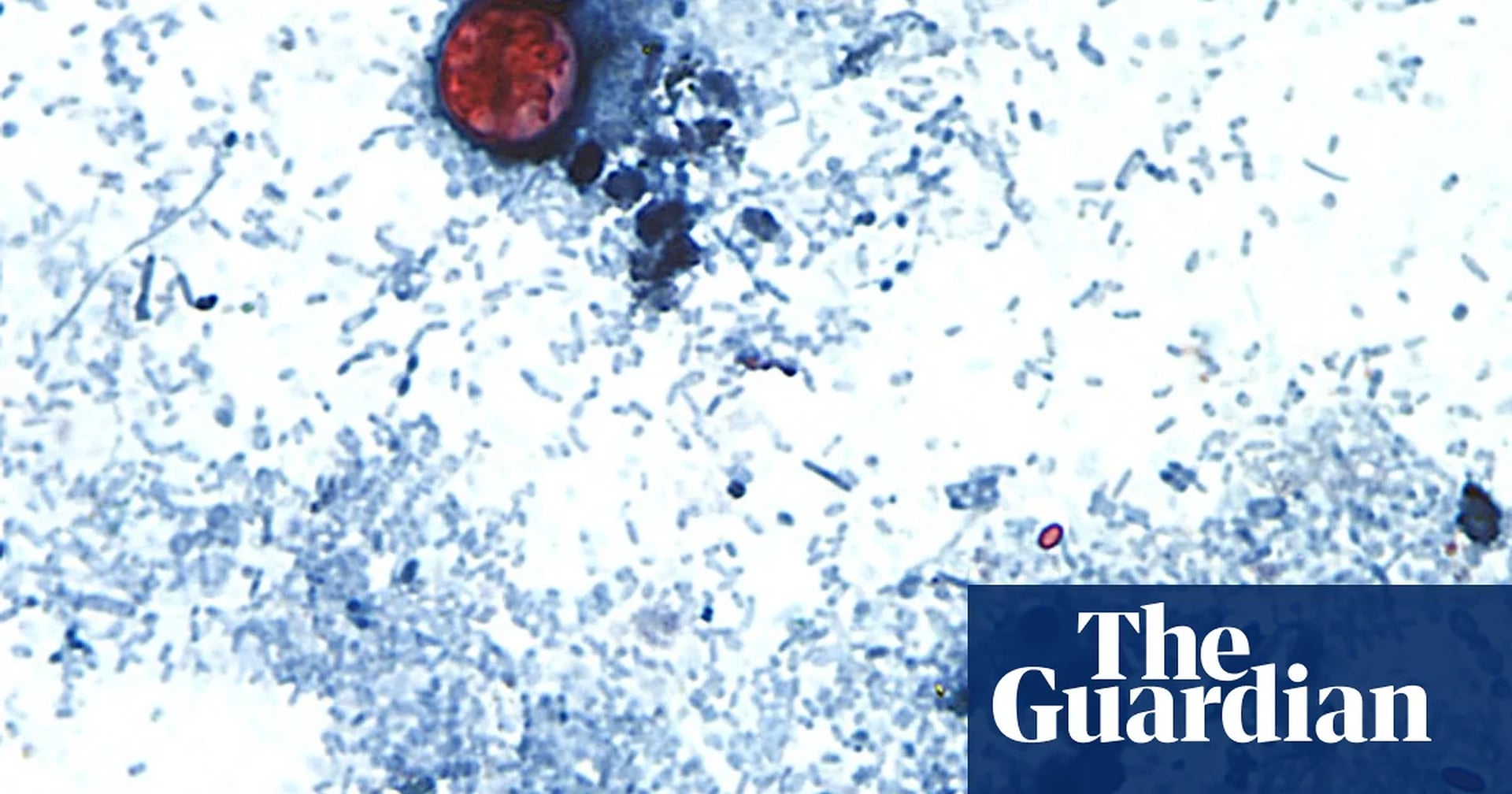 Global Health and Education Watch: Is the cyclosporiasis outbreak slowing? Test-makers are hopeful