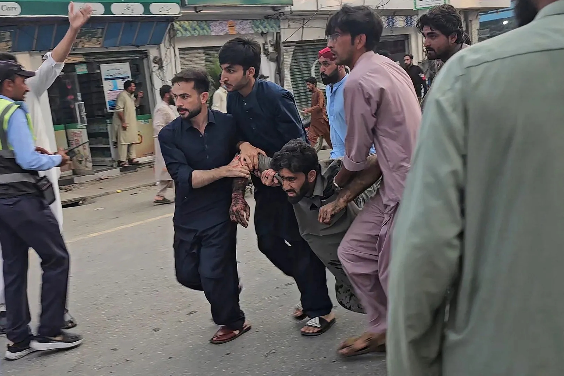 Global Health and Education Watch: Suicide bombing kills at least 14 people in Pakistan’s