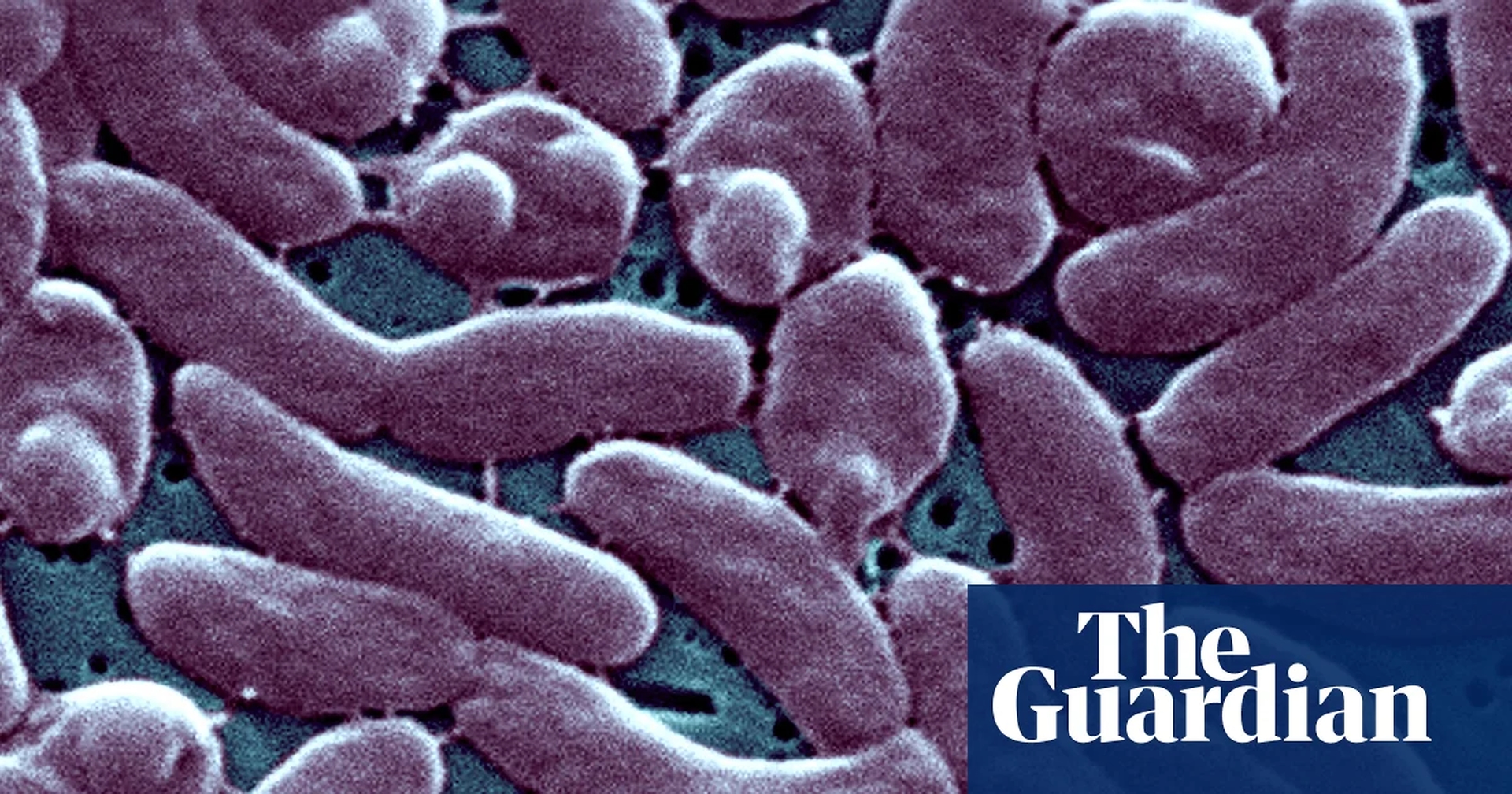 Global Health and Education Watch: Louisiana warns beachgoers amid surge in flesh-eating bacteria infections